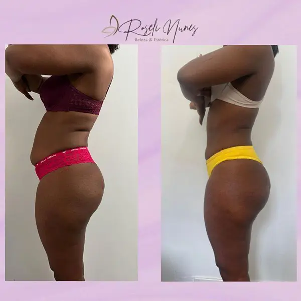 IMG LP ROSELI 15 - BODY FIT